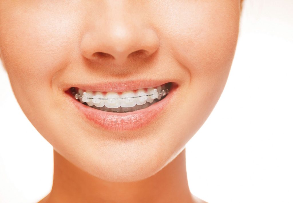Ortodoncia y Estética Dental